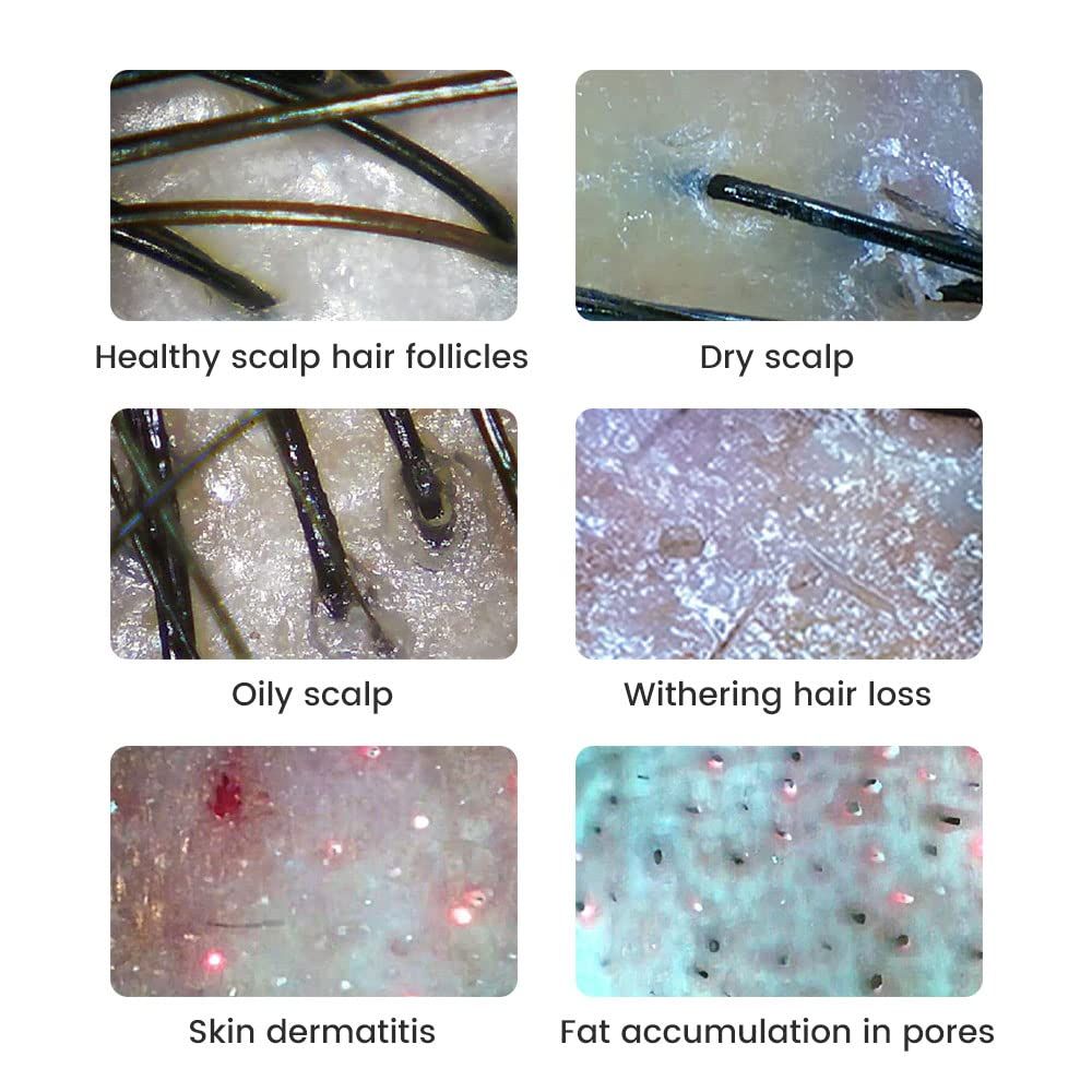 Digitálny mikroskop 500x zväčšenie 2MP – Oprava elektroniky, mince, koža, vlasy