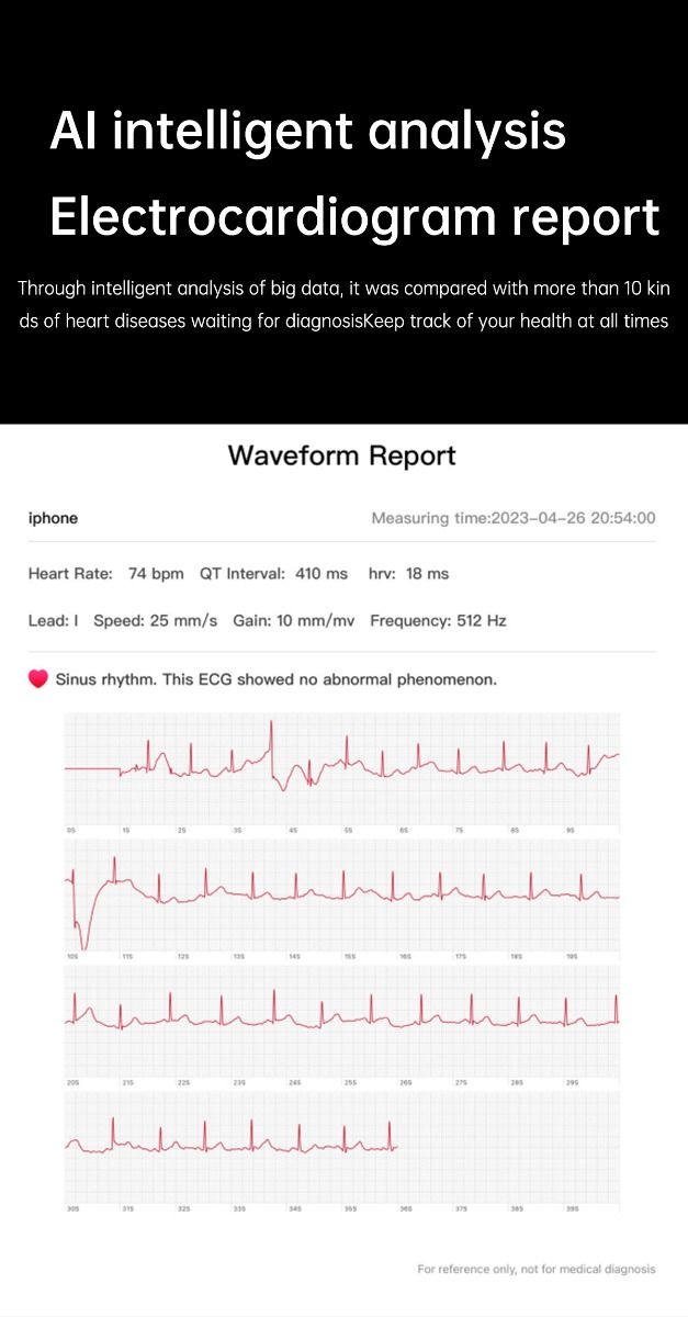 ET540 EKG Smartwatch s glukózou a telesnou teplotou, Bluetooth hovor, Fitness Sledovač pre Zdravie