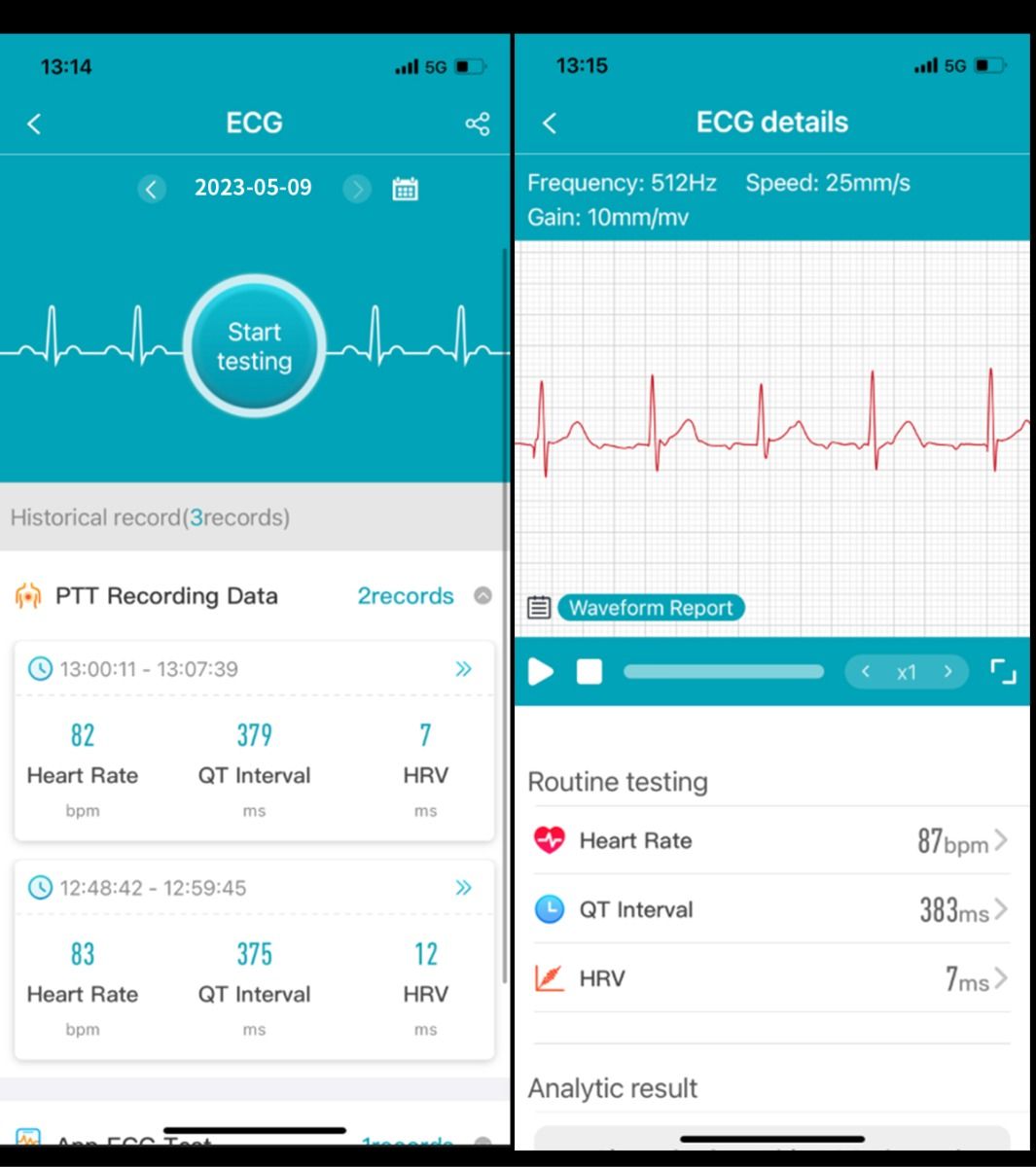 ET540 EKG Smartwatch s glukózou a telesnou teplotou, Bluetooth hovor, Fitness Sledovač pre Zdravie