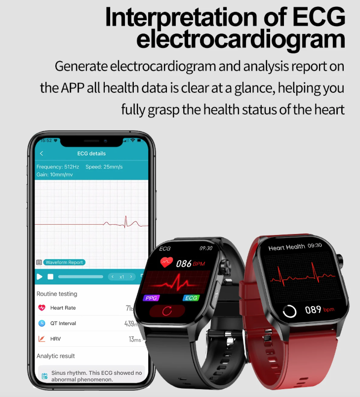 E580 inteligentné hodinky: Meranie glukózy, EKG, srdca a tlaku. IP68. Váš strážca zdravia!